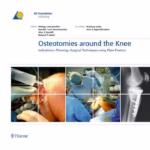 OSTEOTOMIES AROUND THE KNEE(Indian reprint)