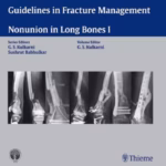 Non Union in Long Bones I
