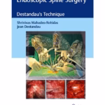 Endoscopic Spine Surgery - 1st Edition Clinical Guide