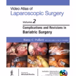 Video Atlas of Laparoscopic Surgery Vol. 2: Complications and Revisions in Bariatric Surgery with DVD-ROM - Medical Textbook