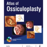 Atlas Of Ossiculoplasty