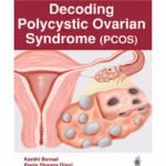 Decoding Polycystic Ovarian Syndrome (PCOS) - Clinical Guide