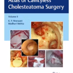 Atlas of Cavityless Cholesteatoma Surgery - Volume 2 Clinical Reference