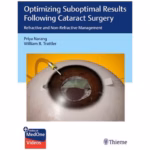 Optimizing Suboptimal Results Following Cataract Surgery - 1st Edition Clinical Guide