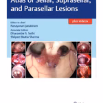 Atlas of Sellar, Suprasellar, and Parasellar Lesions - 1st Edition Medical Textbook