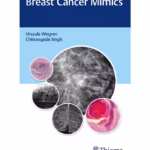 Breast Cancer Mimics - 1st Edition Medical Textbook