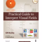 Practical Guide To Interpret Visual Fields