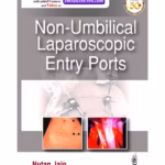 Non-Umbilical Laparoscopic Entry Ports - Clinical Guide