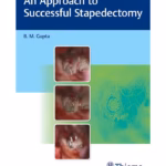 Approach to Successful Stapedectomy - 1st Edition Medical Textbook