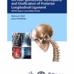 Cervical Spondylotic Myelopathy and OPLL - 1st Edition Clinical Guide