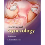 Essentials of Gynecology - 3rd Edition Medical Textbook