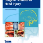 Surgical Nuances Of Head Injury 1st Ed.