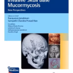 Invasive Skull Base Mucormycosis - 1st Edition Clinical Guide