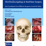 100 Complications of Otorhinolaryngology and Skull Base Surgery - 1st Edition Medical Textbook