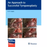 An Approach to Successful Tympanoplasty 1st Ed.