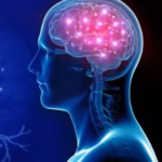 Neurology
