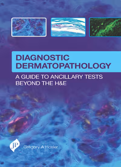 Diagnostic Dermatopathology:A Guide To Ancillary Tests Beyond the H&E - 1st Edition