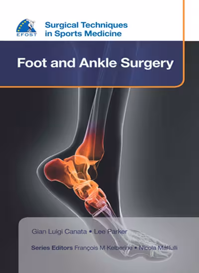 Surgical Techniques in Sports Medicine Foot and Ankle Surgery - 1st Edition