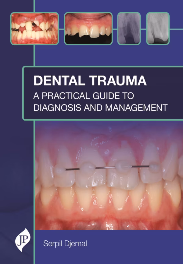 Dental Trauma: A Practical Guide To Diagnosis and Management - 1st Edition