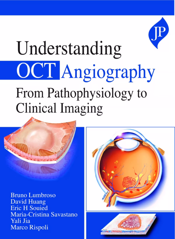 Understanding Oct Angiography From Pathophysiology To Clinical Imaging - 1st Edition