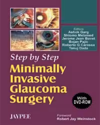 Step By Step Minimally Invasive Glaucoma Surgery with Dvd-Rom - 1st Edition