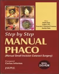 Step By Step Manual Phaco with Dvd-Rom - 1st Edition
