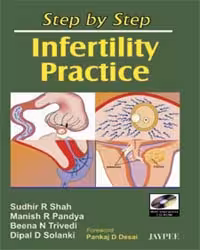 Step By Step Infertility Practice with Cd-Rom - 1st Edition