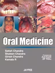 Oral Medicine - 1st Edition