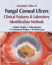 Aravind'S Atlas of Fungal Corneal Ulcers Clinical Features & Lab.Identification Methods - 1st Edition