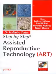 Step By Step Assisted Reproductive Technology(Art) with 2 Int.Dvd-Roms Dr.Malhotra Series - 1st Edition