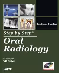 Step By Step Oral Radiology with Photo Cd-Rom - 1st Edition