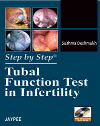 Step By Step Tubal Function Test in Infertility with Dvd-Rom - 1st Edition
