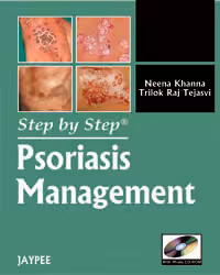 Step By Step Psoriasis Management with Photo Cd-Rom - 1st Edition