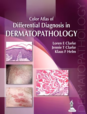 Color Atlas of Differential Diagnosis in Dermatopathology - 1st Edition