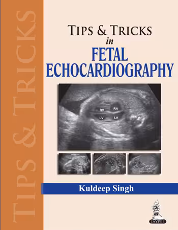 Tips & Trics in Fetal Echocardiography - 1st Edition