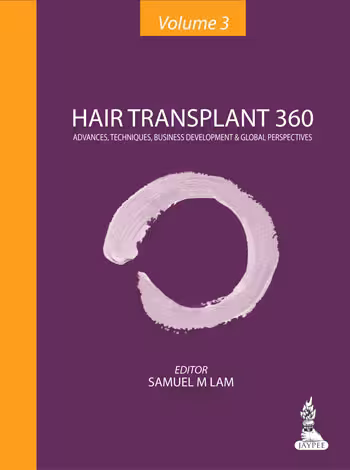 Hair Transplant 360 Vol.3 Advances, Techniques, Business Development, and Global Perspectives - 1st Edition