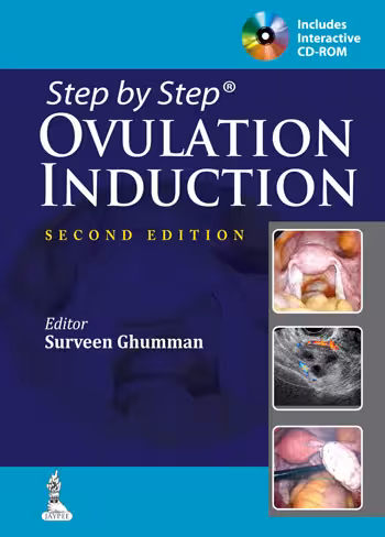Step By Step Ovulation Induction with Cd-Rom - 2nd Edition