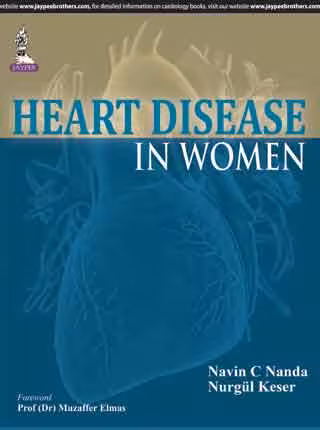 Heart Disease in Women - 1st Edition
