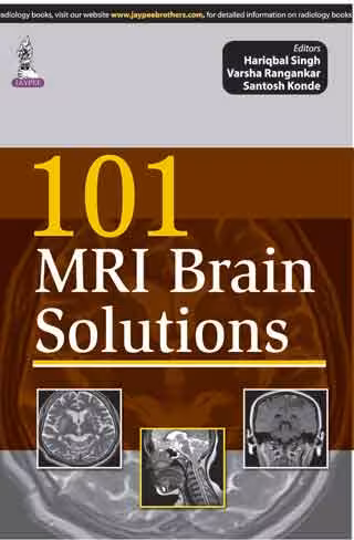 101 Mri Brain Solutions - 1st Edition