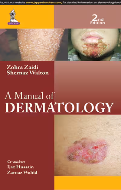 A Manual of Dermatology - 2nd Edition