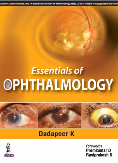 Essentials of Ophthalmology - 1st Edition Reprint