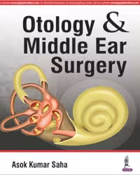 Otology & Middle Ear Surgery - 1st Edition