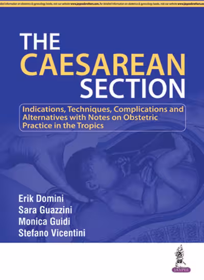 The Caesarean Seciton - 1st Edition