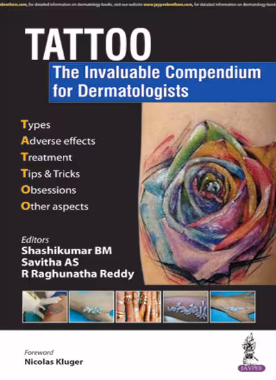 Tattoo:The Invaluable Compendium for Dermatologists - 1st Edition