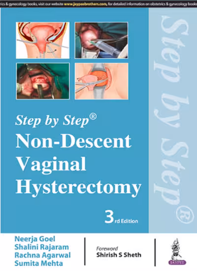 Step By Step Non-Descent Vaginal Hysterectomy - Third Edition