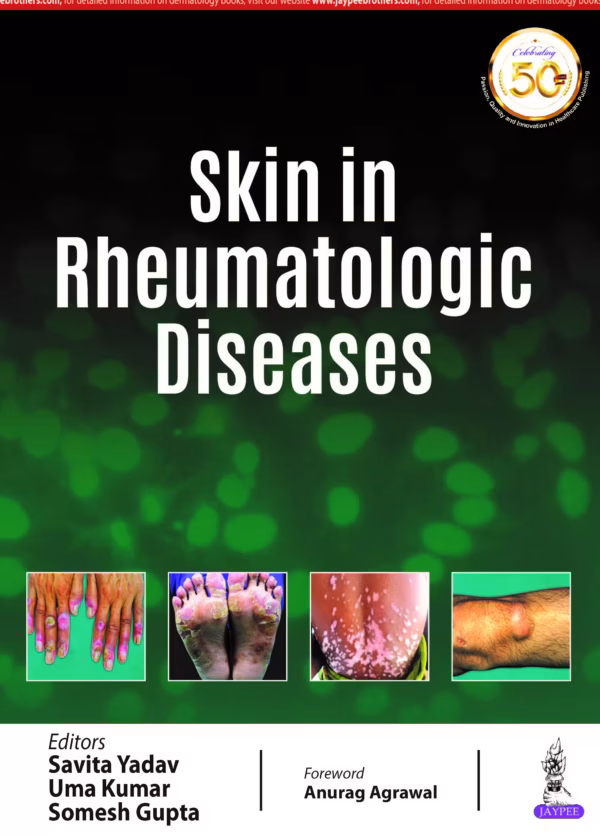 Skin in Rheumatologic Diseases - 1st Edition