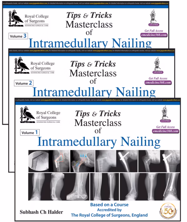 Tips & Tricks Masterclass of Intramedullary Nailing (3 Volumes): Based On A Course Accredited By the - 1st Edition