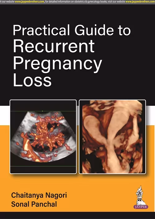 Practical Guide To Recurrent Pregnancy Loss - 1st Edition Reprint
