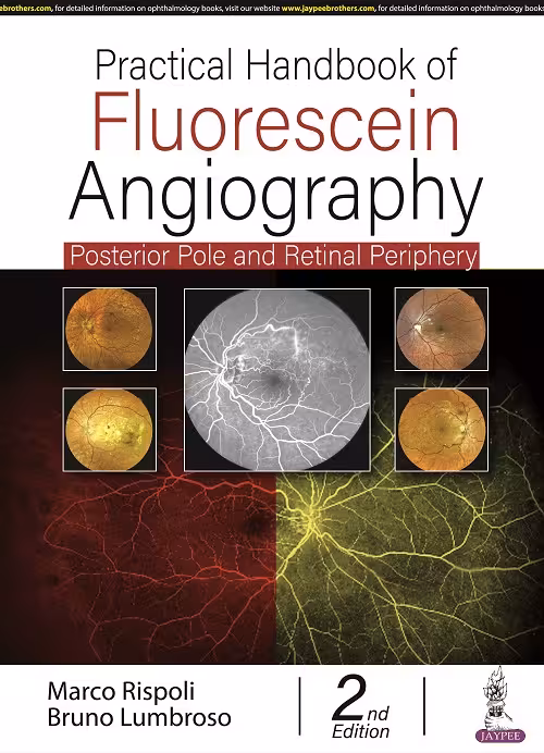 Practical Handbook of Fluorescein Angiography: Posterior and Retinal Periphery - 2nd Edition