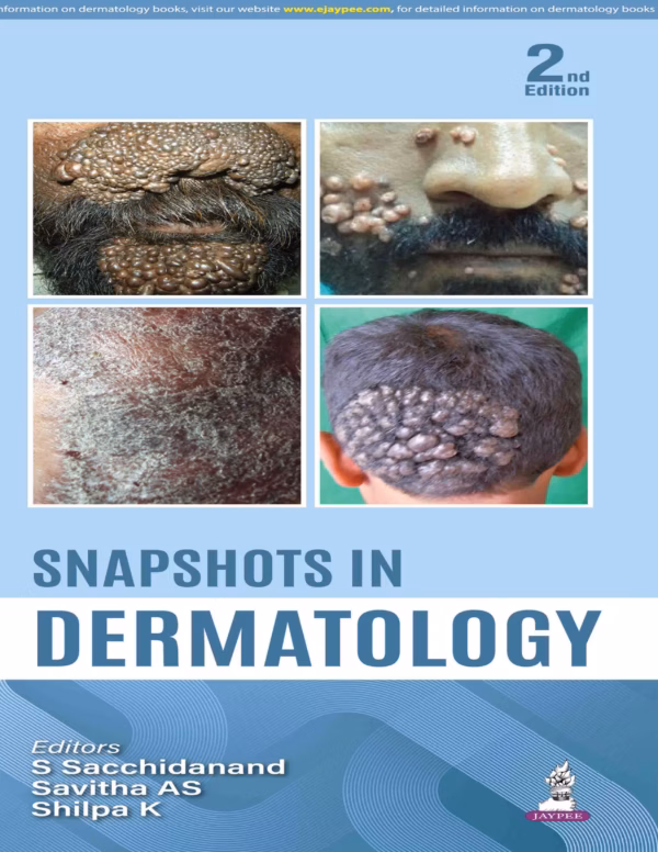 Snapshots in Dermatology - 2nd Edition